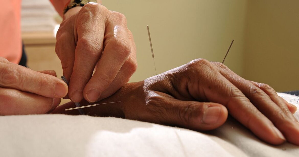 What are acupuncture’s positive effects on health?